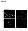 Fig. 03 - Method of modulating epithelial cell activity by modulating the functional levels of sphingosine kinase
