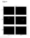Fig. 16 - Method of modulating epithelial cell activity by modulating the functional levels of sphingosine kinase