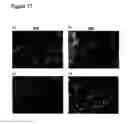 Fig. 18 - Method of modulating epithelial cell activity by modulating the functional levels of sphingosine kinase