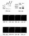 Fig. 09 - BIVM (basic, immunoglobulin-like variable motif-containing) gene, transcriptional products, and uses thereof