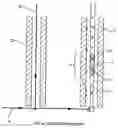 Fig. 01 - Autothermal cracking process