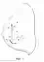 Fig. 04 - Temporary catheter for biopsy site tissue fixation