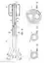 Fig. 05 - Temporary catheter for biopsy site tissue fixation