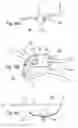 Fig. 07 - Apparatus and method for treating female urinary incontinence