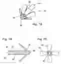 Fig. 08 - Apparatus and method for treating female urinary incontinence