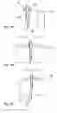 Fig. 09 - Apparatus and method for treating female urinary incontinence