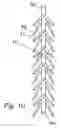 Fig. 11 - Apparatus and method for treating female urinary incontinence