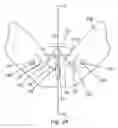 Fig. 27 - Apparatus and method for treating female urinary incontinence