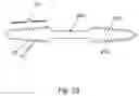 Fig. 30 - Apparatus and method for treating female urinary incontinence