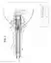Fig. 04 - Urinary flow control device and method