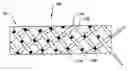 Fig. 01 - Surgical slings