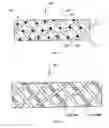 Fig. 02 - Surgical slings