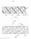 Fig. 03 - Surgical slings
