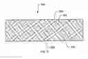 Fig. 04 - Surgical slings