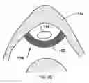 Fig. 08 - Surgical slings