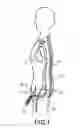 Fig. 02 - Penile erection control method and penile erection control device