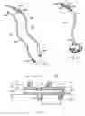 Fig. 04 - Rotate-to-advance catheterization system