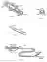 Fig. 05 - Rotate-to-advance catheterization system