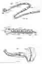 Fig. 13 - Rotate-to-advance catheterization system