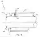Fig. 15 - Rotate-to-advance catheterization system