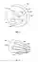 Fig. 08 - Catheter tip electrode assembly and method for fabricating same