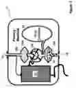 Fig. 04 - Apparatus and method for ablating deposits from blood vessel