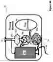 Fig. 07 - Apparatus and method for ablating deposits from blood vessel