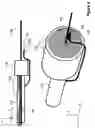 Fig. 10 - Apparatus and method for ablating deposits from blood vessel