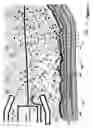 Fig. 17 - Apparatus and method for ablating deposits from blood vessel