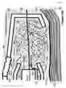 Fig. 19 - Apparatus and method for ablating deposits from blood vessel