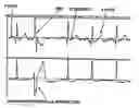 Fig. 01 - System for analysis of biological voltage signals