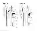 Fig. 09 - Articulating joint