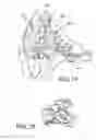 Fig. 09 - Post operative knee brace with multiple adjustment features