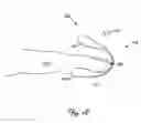 Fig. 06 - Bandage with splint