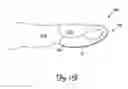 Fig. 08 - Bandage with splint