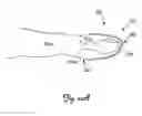 Fig. 09 - Bandage with splint