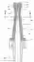 Fig. 12 - Medical valve and method of use