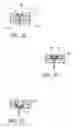 Fig. 05 - Attachment system for transmural attachment at the gastroesophageal junction