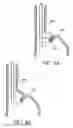 Fig. 08 - Attachment system for transmural attachment at the gastroesophageal junction