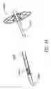 Fig. 27 - Attachment system for transmural attachment at the gastroesophageal junction
