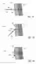 Fig. 32 - Attachment system for transmural attachment at the gastroesophageal junction