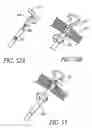 Fig. 40 - Attachment system for transmural attachment at the gastroesophageal junction