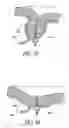 Fig. 45 - Attachment system for transmural attachment at the gastroesophageal junction