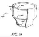 Fig. 47 - Attachment system for transmural attachment at the gastroesophageal junction