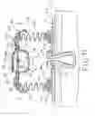 Fig. 08 - Controlled evacuation ostomy device with external seal