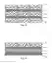 Fig. 10 - Planar-formed absorbent core structures