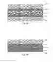 Fig. 12 - Planar-formed absorbent core structures