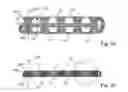 Fig. 03 - Absorbent core structures having undulations
