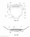 Fig. 16 - Disposable absorbent articles having multiple absorbent core components including replaceable components