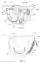Fig. 04 - Disposable absorbent articles having multiple absorbent core components including replaceable components